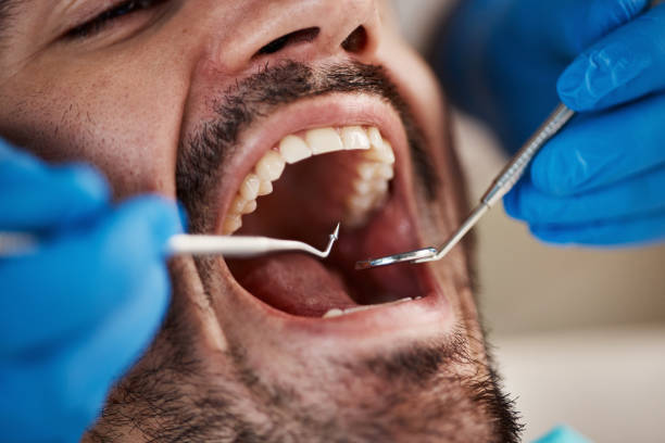Best Emergency Treatment for Toothache in Cottonport, LA